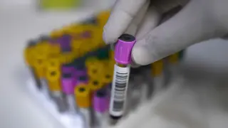 ДНК на опасен вирус открита върху страниците на средновековно Евангелие